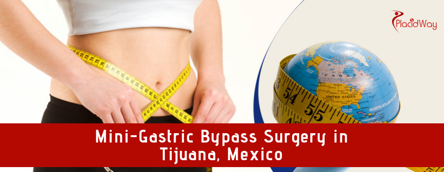 Mini-Gastric Bypass Surgery in Tijuana, Mexico